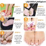 نحوه استفاده ارتودنسی ناخن فلزی
