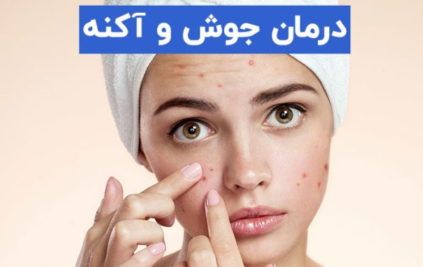 درمان جوش و آکنه