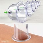 بادکش بدن طبی 6 سر (بادکشی و حجامت