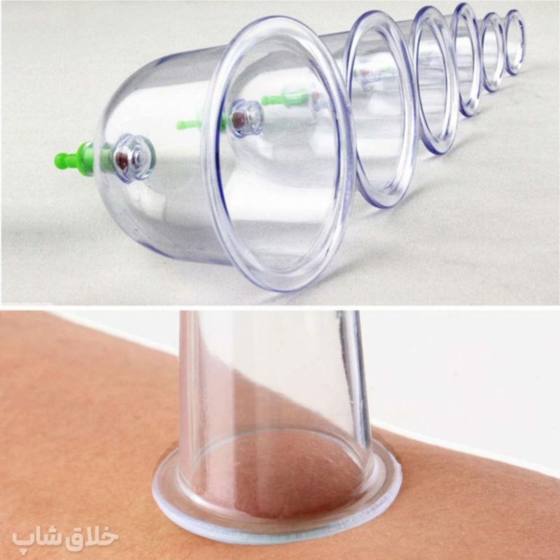 بادکش بدن طبی 6 سر (بادکشی و حجامت