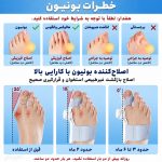 اصلاح انحراف شست پا-آتل انگشت پا درمان هالوکس والگوس
