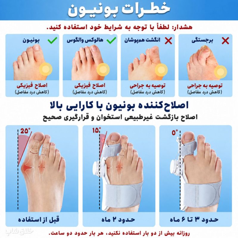 اصلاح انحراف شست پا-آتل انگشت پا درمان هالوکس والگوس