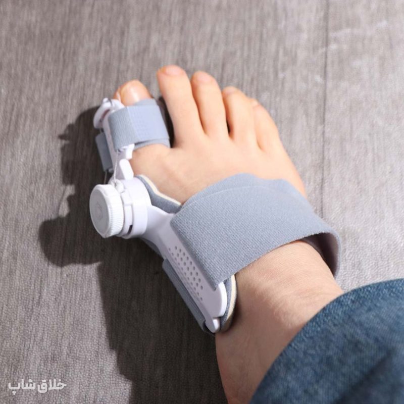 اصلاح انحراف شست پا-آتل انگشت پا درمان هالوکس والگوس