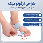 اصلاح انحراف شست پا-آتل انگشت پا درمان هالوکس والگوس