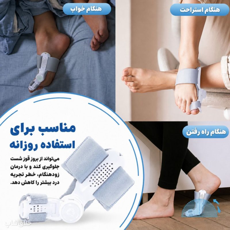 اصلاح انحراف شست پا-آتل انگشت پا درمان هالوکس والگوس